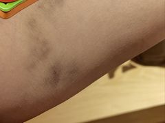 -江南大学附属医院(北院区)