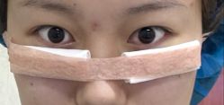 -长沙雅美医疗美容医院