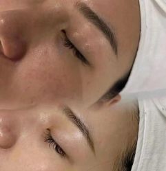 -天津伊美尔医疗整形美容专科医院