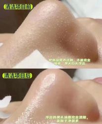 -凡碧诗毛孔清洁收细