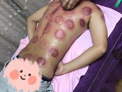-沈师傅盲人按摩工作室(密三小区店)