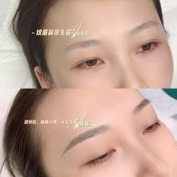 -久匠半永久纹眉