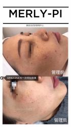 -MLP美丽派·问题肌疗愈中心