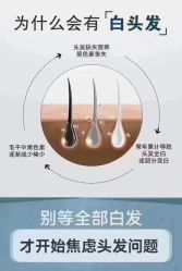 -诗碧曼养发