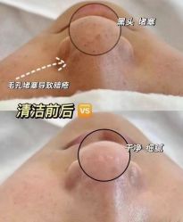 -艾尚妮·美容美体SPA