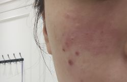 -广州美莱医疗美容医院