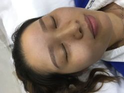 点击看大图 -郡艺医疗美容·微整·眼鼻吸脂