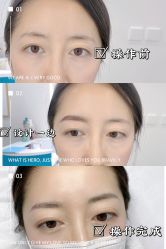 点击看大图 -久匠·纹眉纹绣半永久