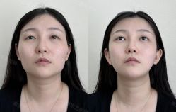 -Yestar艺星医疗美容医院