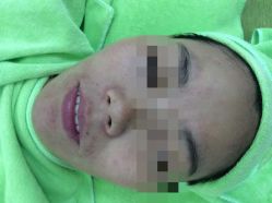 -苗医生草本科技祛痘