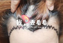 -大麦微针植发全国连锁