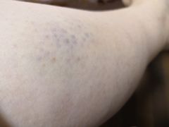 -郑远元专业修脚房(国顺东路店)