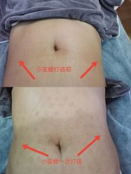 -清媚减肥瘦身纤体