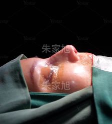 -Yestar重庆艺星医疗美容医院