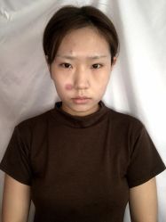 -成都军建医院·疤痕诊疗中心