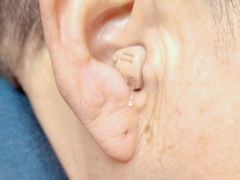 -自然之声助听器·呼吸机(公园路店)