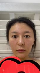 体验前-BR光电保养