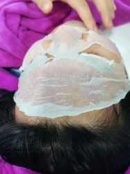 -蕾特恩祛痘•皮肤管理