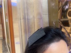 -碧莲盛·不剃发植发