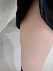 体验后-美莱医疗美容医院