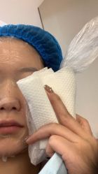 体验后-成都艾特他整形外科医院