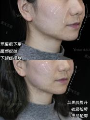 -Yestar重庆艺星医疗美容医院