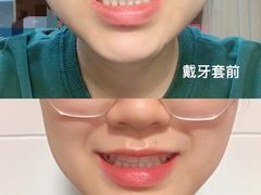 -极光口腔·矫正种植修复(锦江店)