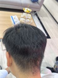 -雍禾植发