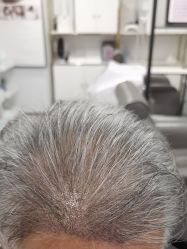 -熙朵美学植发·连锁品牌