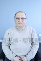 -型男帮男士假发补发·佩戴式发型