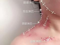 -施奈儿.洗头頭療.按摩SPA.采耳(上梅林店)