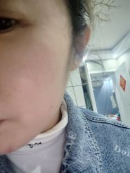 体验后-SKINIST丽铂医疗美容