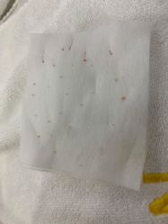 -蕾特恩专业祛痘·皮肤管理