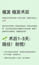 -极客侠男士假发定制补发