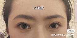 体验后-沈阳名流美容医院