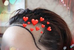 -大麦微针植发全国连锁