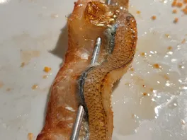 针**