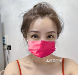 体验后-上海时光整形外科医院