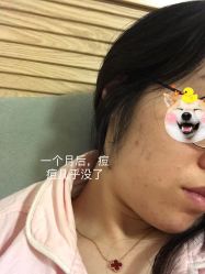 -美肤盾祛痘·问题肌头疗管理中心