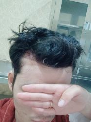 -新生植发·植养护一体