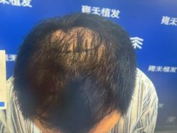 -雍禾植发全国连锁