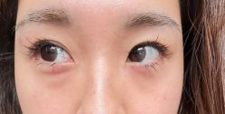 -天津健丽·去眼袋医疗美容机构