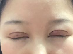 -坤如玛丽·医疗美容中心