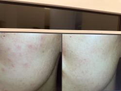 -苑苑vbeauty科技美容SPA