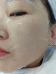 体验后-联合丽格·张菡丽格医疗美容