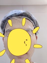 体验后-杭州米兰柏羽医疗美容医院