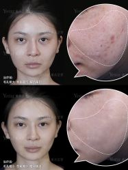 -Yestar重庆艺星医疗美容医院