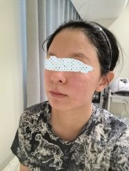 -海涛医疗美容·面部抗衰·注射美鼻