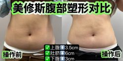 -苗塑堂减肥·艾灸