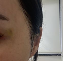 -安徽合肥韩美整形外科医院